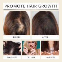 Esencia Nutre el cuero cabelludo, hidrata, suaviza, reafirma, deja un aceite esencial fragante para el cuidado del cabello. - details 10