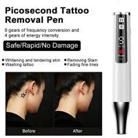 Pluma de plasma para belleza, eliminación de verrugas, pecas, nevos, puntos de acné, eliminación de manchas, lápiz láser de belleza para eliminación. - details 5
