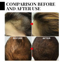 Jaysui Batana Ball nutritivo para las raíces del cabello, cabello grueso y fuerte, cuidado del masaje del cuero cabelludo - details 8