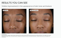 Alastin Skincare Anti-Aging Face Treatment Fine Lines Wrinkles Redness Discoloration Retinol