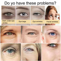 Crema de Cuidado de Ojos Instantáneo Anti-Ojeras Serum Hidratante para Eliminación de Arrugas - details 2