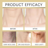 Ingredientes suaves, crema hidratante y nutritiva para el cuidado del cuello, masaje diario, belleza. - details 11