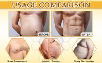 Thermofirm Bee Venom Gynecomastia Oil