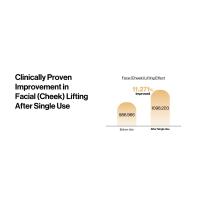 Facial Lifting
