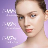 Nicotinamida elimina el melasma, mancha blanca, crema para pecas, aclara la melanina, ilumina el tono de la piel, hidrata el cuidado de la piel facial, maquillaje - details 2