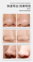 Limpiador facial eléctrico doméstico, instrumento de belleza, limpiador facial, removedor de acné y puntos negros - details 5