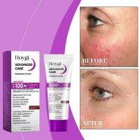 FSP 100+ Crema de protección solar ligera, alivio de la piel, bloqueo UV, hidratante - details 3