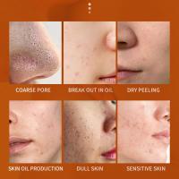 Exfoliante - Glow Blanqueador Y Exfoliante, Exfoliante Facial con Azúcar, Exfoliante Orgánico para Rostro y Cuerpo para una Piel Más Suave (1PC) - details 5