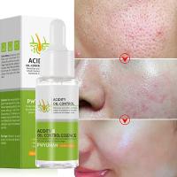 Crema Reductora de Poros de Ácido Salicílico Adiós a los Pulgares, Reparación de Piel, Estiramiento - details 23