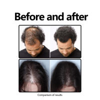 Líquido de esencia para el cuidado del cabello, suavizante, nutritivo, endurecedor a base de hierbas - details 8