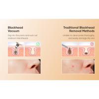 blackhead extractor