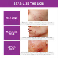 Crema aclaradora de manchas, marcas de acné, elimina el melasma, tratamiento de manchas oscuras, hidratante, opacidad, brillo de la piel, cuidado Facial - details 4
