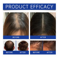 Spray de esencia para el cuidado del cabello hidratante, suave y brillante, nutritivo con péptidos de cobre azul - details 7