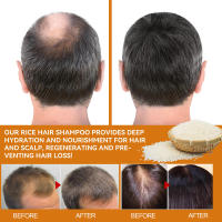 Champú de arroz para limpieza profunda, hidratación densa, fijación de raíces y cuidado del cabello. - details 7