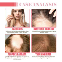 Denso hidrata las raíces, repara el cabello seco y encrespado, previene la caída del cabello y lo fija con aceite esencial. - details 6