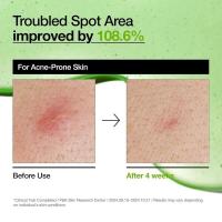 Anua Azelaic Acid 10 Hyaluron Redness Soothing Serum, Suero facial para pieles sensibles, Ácido hialurónico, Niacinamida, Cuidado de manchas, - details 2