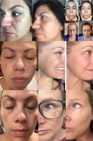 Suero Blanqueador Corrector de Manchas Dark Spots Iluminador de Piel Cuidado de Belleza Coreano - details 3