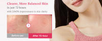 txa serum