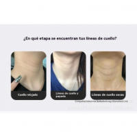 Masajeador EMS Herramienta de Cuidado de la Belleza para Aliviar Líneas de Cuello - details 3