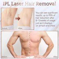 Depiladora láser IPL para mujeres, dispositivos de uso doméstico, depilación eléctrica indolora, Bikini, envío directo - details 14