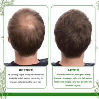 Aceite esencial de romero hidratante y nutritivo para cabello dañado - details 7
