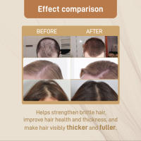 Gotas dietéticas densas que nutren las raíces, previenen la caída, fortalecen y reafirman el suplemento para el cuidado del cabello - details 8