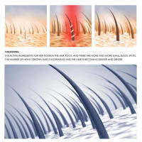 Esencia hidratante suave para el cuidado del cabello seco y jengibre para el cuero cabelludo - details 4