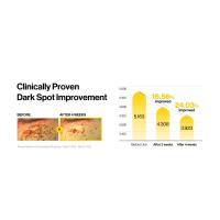 Dark Spot Improvement