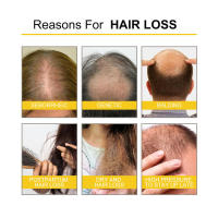 Hidrata, repara densamente las raíces, el cabello dañado, fortalece y reafirma el aceite esencial para el cuidado del cabello. - details 7