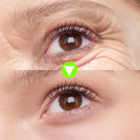 Crema para los Ojos de Turmeric y Vitamina C Secado Rápido, Hidratante, Refrescante - details 8