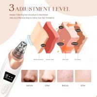 Est Technology-eliminador de poros al vacío, Kit de eliminación de espinillas de cara y nariz, herramienta eléctrica extractora Facial de acné - details 6