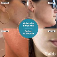 Suero de ácido hialurónico TruSkin para rostro + 7 ingredientes ultrahidratantes: el mejor suero facial para hidratar, rellenar visiblemente la piel y suavizar el aspecto de las líneas finas, 2 fl oz - details 15