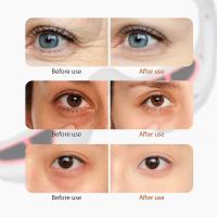 Masajeador de ojos, ojeras, eliminación de bolsas de ojos, cuidado de los ojos, máquina de belleza - details 3