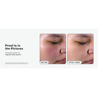 Paula's Choice SKIN PERFECTING 2% BHA Exfoliante líquido de ácido salicílico-exfoliante facial para puntos negros, poros agrandados y arrugas - details 6