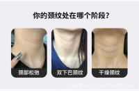 Masajeador de Cuello EMS Herramienta de Cuidado de la Piel Facial para Eliminación de Rayas y Elevación y Refuerzo del Cuello - details 4