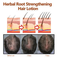 Loción de raíz de hierbas que fija la línea densa, repara, endurece, hidrata y previene la caída del cabello - details 8