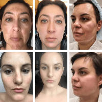Crema blanqueadora para pecas, melasma, manchas oscuras, producto de eliminación de pigmentación, mancha que se desvanece, melanina, reparación rápida, ilumina el cuidado de la piel coreano - details 0