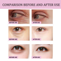 OUHOE Retinol Eye Stick Reducción de Ojeras, Adelgazamiento de Piel, Promoción de Piel Suave y Delicada Herramienta de Cuidado de la Piel Facial - details 3