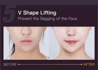 Instrumento de masaje facial con V vending para lifting y adelgazamiento facial - details 7