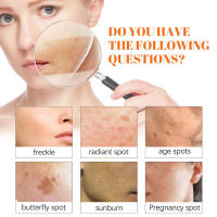 Crema facial blanqueadora de pecas, Corrector de manchas solares de día y noche de Papaya, pigmento que se desvanece, ilumina el tono de la piel, blanquea las imperfecciones, nutritiva - details 3