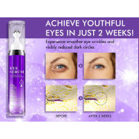 eye bags treatment for women eye cream anti aging dark circles under eye treatment women
