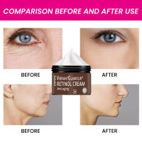 Crema Facial Retinol antienvejecimiento elimina arrugas reafirmante Lifting blanqueamiento crema hidratante brillante cuidado de la piel Facial - details 1