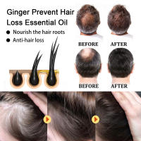 Ginger Care Raíces suaves, nutritivas e hidratantes, nutritivo, cuidado del cabello, aceite esencial para masaje del cuero cabelludo - details 8