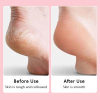 Removedor de callos eléctrico, lima de pies profesional, máquina de pedicura, talón recargable, eliminación de piel muerta agrietada, papel de lija para pies, exfoliante - details 8