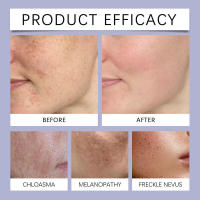 La crema facial HOYGI reabastece la humedad, nutre la delicada de la cara, la suaviza, la hace radiante y es una piel diaria. - details 8