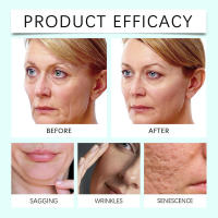 La crema de colágeno para el cuidado hidrata el tono de la piel, reafirma la piel, rejuvenece y revitaliza la crema facial. - details 8