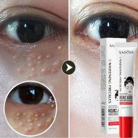 Crema para ojos eliminadora de gránulos de grasa, crema firme antiinflamatoria, Reduce las ojeras, desvanece las líneas finas, barrera de reparación Sk - details 2