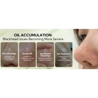 oil accumulation
