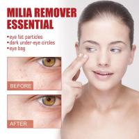 Sérum de Eliminación de Gránulos de Ojo de 30ml Efectivo contra Partículas, Mejora el Enrojecimiento, Cuidado de la Piel de Belleza - details 7