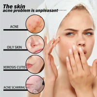 5ML/15ML/30ML/50ML/aceites esenciales de esencia facial vitamina E aceite para la piel 100% suero facial natural antiarrugas hidratante blanqueamiento apretado - details 3